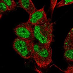 anti-Islet-1, Polyclonal, Novus Biologicals 0.1mL; Unlabeled:Antibodies,